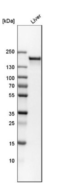 CPS1 Antibody, Novus Biologicals 0.1mL; Unlabeled:Antibodies, Polyclonal