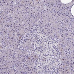 CPVL Antibody, Novus Biologicals:Antibodies:Primary Antibodies