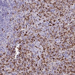 CPVL Antibody, Novus Biologicals:Antibodies:Primary Antibodies