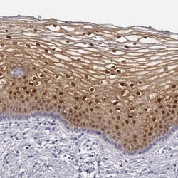 CRABP1 Antibody, Novus Biologicals:Antibodies:Primary Antibodies