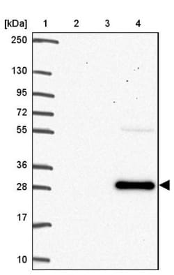 CRACC/SLAMF7 Antibody, Novus Biologicals:Antibodies:Primary Antibodies