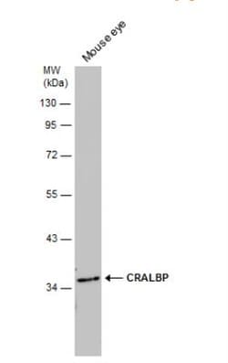 CRALBP Antibody, Novus Biologicals 0.1mL; Unlabeled:Antibodies, Polyclonal