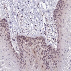 CRAMP1L Antibody, Novus Biologicals 25 &mu;L, Unlabeled:Antibodies, Polyclonal