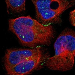 CRB3 Antibody, Novus Biologicals 0.1mL; Unlabeled:Antibodies, Polyclonal