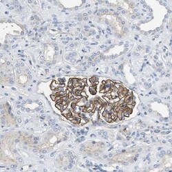 CRB3 Antibody, Novus Biologicals 0.1mL; Unlabeled:Antibodies, Polyclonal