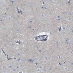CRB3 Antibody, Novus Biologicals 0.1mL; Unlabeled:Antibodies, Polyclonal