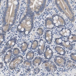 CRB3 Antibody, Novus Biologicals 0.1mL; Unlabeled:Antibodies, Polyclonal