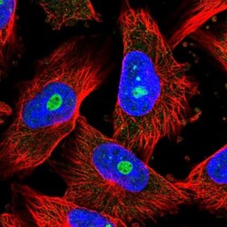 CRBN Antibody, Novus Biologicals 0.1mL; Unlabeled:Antibodies, Polyclonal