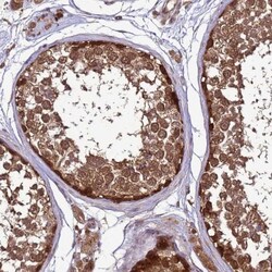 CRBN Antibody, Novus Biologicals 0.1mL; Unlabeled:Antibodies, Polyclonal