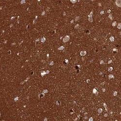 CRBN Antibody, Novus Biologicals 0.1mL; Unlabeled:Antibodies, Polyclonal