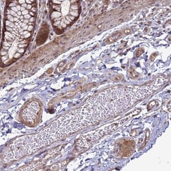 CRBN Antibody, Novus Biologicals 0.1mL; Unlabeled:Antibodies, Polyclonal