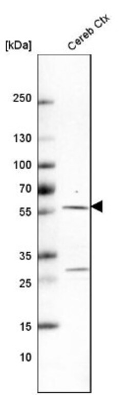 CRBN Antibody, Novus Biologicals 0.1mL; Unlabeled:Antibodies, Polyclonal