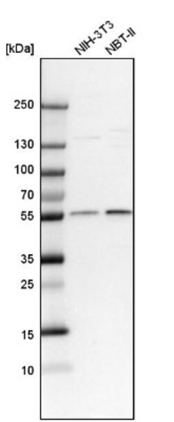 CRBN Antibody, Novus Biologicals 0.1mL; Unlabeled:Antibodies, Polyclonal