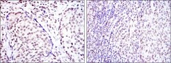 CREB Antibody (5G3), Novus Biologicals 0.1mL; Unlabeled:Antibodies, Monoclonal