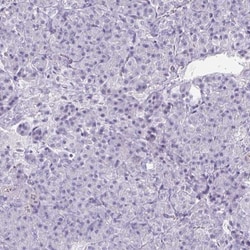 PPIL2 Antibody, Novus Biologicals:Antibodies:Primary Antibodies