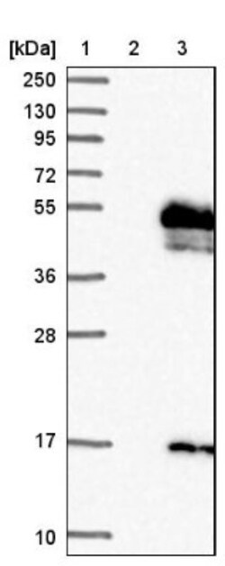 CRELD1 Antibody, Novus Biologicals 25 &mu;L | Buy Online | Novus Biologicals | Fisher Scientific