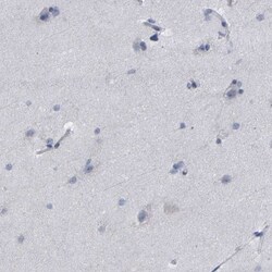 CREM Antibody, Novus Biologicals 0.1mL; Unlabeled:Antibodies, Polyclonal