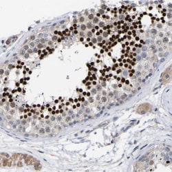 CREM Antibody, Novus Biologicals 0.1mL; Unlabeled:Antibodies, Polyclonal