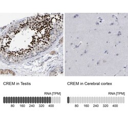 CREM Antibody, Novus Biologicals 0.1mL; Unlabeled:Antibodies, Polyclonal