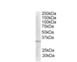 CREM Antibody, Novus Biologicals 0.1mg; Unlabeled:Antibodies, Polyclonal