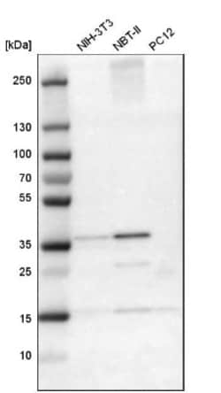 CREM Antibody, Novus Biologicals 0.1mL; Unlabeled:Antibodies, Polyclonal