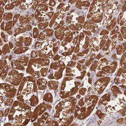 CRHR2/CRF2 Antibody, Novus Biologicals 0.1mL; Unlabeled:Antibodies, Polyclonal