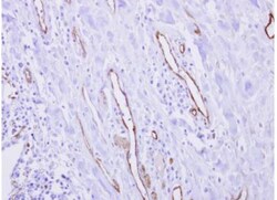 CRIP2 Antibody, Novus Biologicals 0.1mL; Unlabeled:Antibodies, Polyclonal