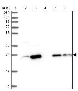 CRIP2 Antibody, Novus Biologicals:Antibodies:Primary Antibodies