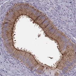 CRISP-1 Antibody, Novus Biologicals 25 &mu;L; Unlabeled:Antibodies, Polyclonal