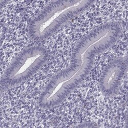 CRISP-1 Antibody, Novus Biologicals 25 &mu;L; Unlabeled:Antibodies, Polyclonal