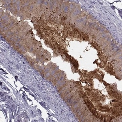 CRISP-1 Antibody, Novus Biologicals 25 &mu;L; Unlabeled:Antibodies, Polyclonal