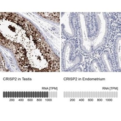 CRISP-2 Antibody, Novus Biologicals 0.1mL; Unlabeled:Antibodies, Polyclonal