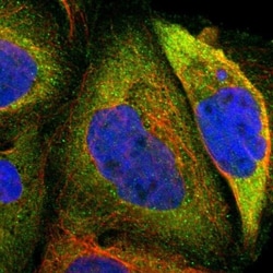 CRLF3 Antibody, Novus Biologicals 0.1mL; Unlabeled:Antibodies, Polyclonal