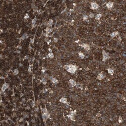 CRLF3 Antibody, Novus Biologicals 0.1mL; Unlabeled:Antibodies, Polyclonal