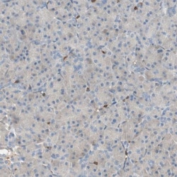 CRLF3 Antibody, Novus Biologicals 0.1mL; Unlabeled:Antibodies, Polyclonal