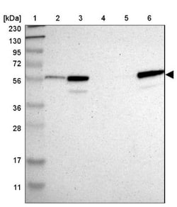 CRLF3 Antibody, Novus Biologicals 0.1mL; Unlabeled:Antibodies, Polyclonal