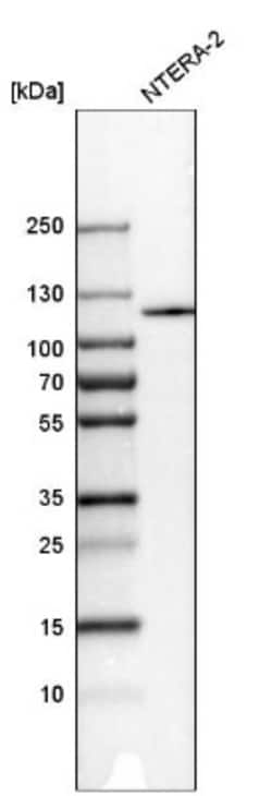 CRM1 Antibody, Novus Biologicals 0.1mL; Unlabeled:Antibodies, Polyclonal