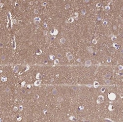 CRMP1 Antibody, Novus Biologicals 0.1mL; Unlabeled:Antibodies, Polyclonal