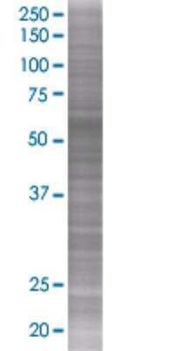Novus Biologicals CRMP5 293T Cell Transient Overexpression Lysate 0.1 mL | Buy Online | Novus Biologicals&trade; | Fisher Scientific