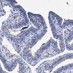 CROCC Antibody, Novus Biologicals 25 &mu;L; Unlabeled:Antibodies, Polyclonal