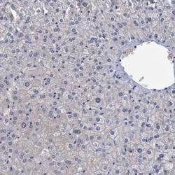 CROCC Antibody, Novus Biologicals 25 &mu;L; Unlabeled:Antibodies, Polyclonal