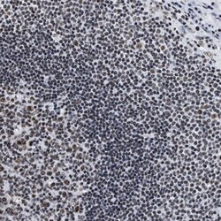 CROP Antibody, Novus Biologicals:Antibodies:Primary Antibodies