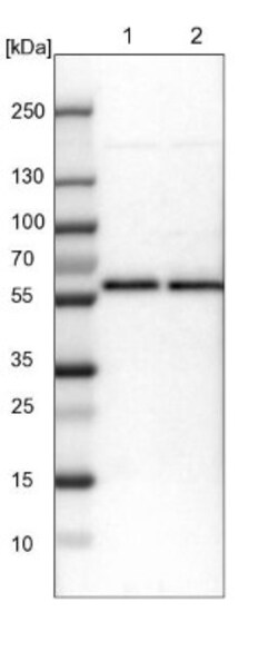 CROP Antibody, Novus Biologicals 0.1mL; Unlabeled:Antibodies, Polyclonal