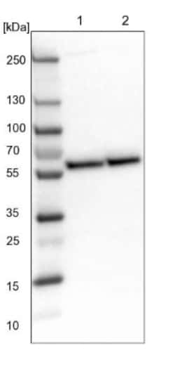 CROP Antibody, Novus Biologicals:Antibodies:Primary Antibodies