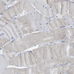 CROT Antibody, Novus Biologicals 0.1 mL | Buy Online | Novus Biologicals | Fisher Scientific
