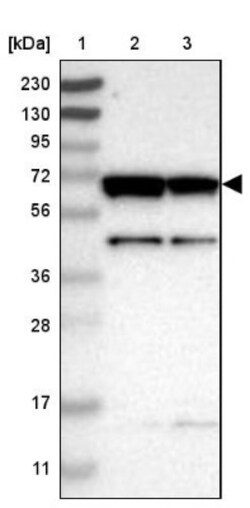 CROT Antibody, Novus Biologicals 0.1mL; Unlabeled:Antibodies, Polyclonal