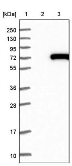 CROT Antibody, Novus Biologicals 0.1 mL | Buy Online | Novus Biologicals | Fisher Scientific