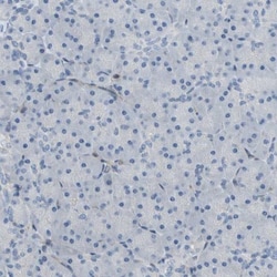 CRTAC1 Antibody, Novus Biologicals 0.1mL; Unlabeled:Antibodies, Polyclonal