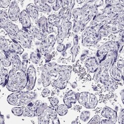 CRX/CORD2 Antibody, Novus Biologicals 25 &mu;L; Unlabeled:Antibodies, Polyclonal