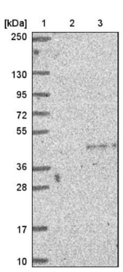 CRX/CORD2 Antibody, Novus Biologicals 0.1mL; Unlabeled:Anticorps, Polyclonal